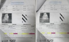 郑州肝病患者临床应用专利软肝